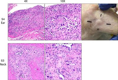 Human Ovarian Cancer Tumor Formation in Severe Combined Immunodeficient (SCID) Pigs